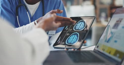 Doctors Reviewing Brain Scan on Tablet in Office