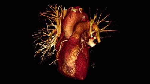 3d animation of human heart structure