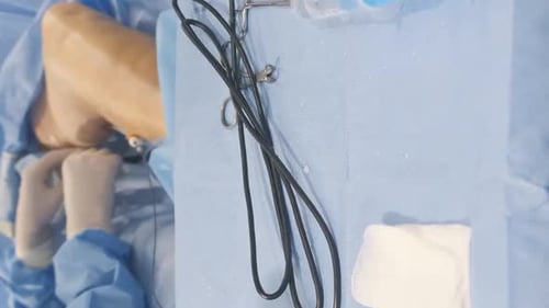 Processes of Treatment of Varicose Veins The Patient is Given Local Anesthesia Vertical Video