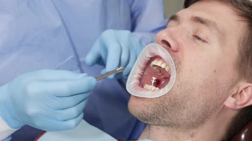Close Up of Dentist Working on Man's Teeth