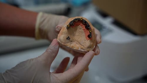 Close-up of dentist hygienist showing denture mold in dental clinic