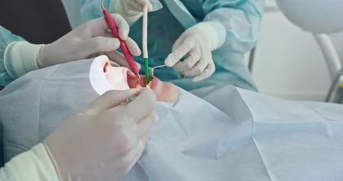 CloseUp of Dental Procedure on Patient in Clinic