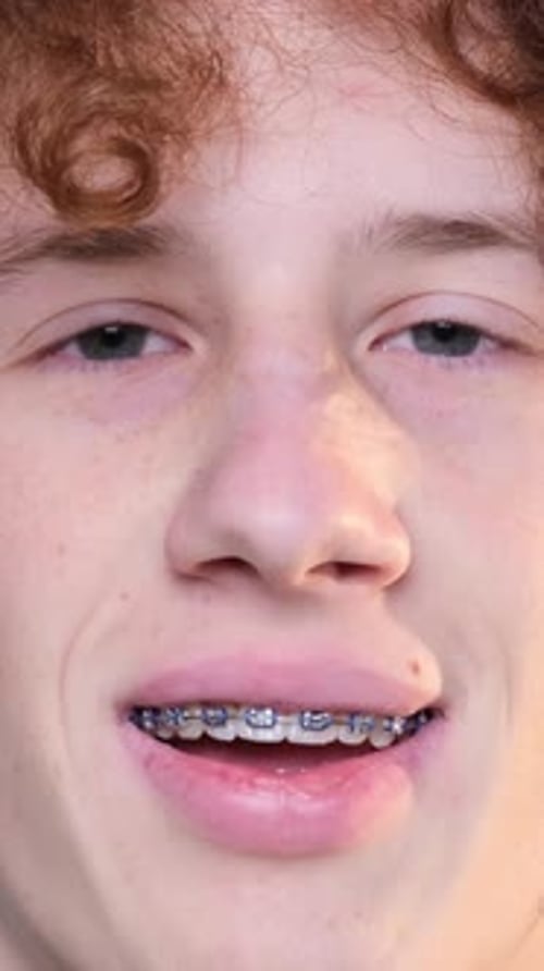 Teen Smile with Braces Close Up Portrait