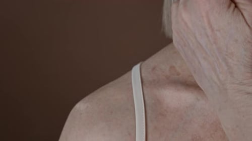 Close Up of Shoulder of Elderly Woman with Age Spots on Skin