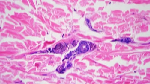 Human Skin with Sweat Glands Against Bright Field at Microscopic 400x Image