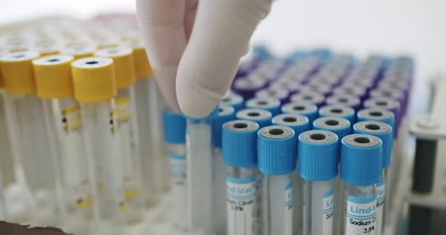 Gloved Hand Placing Test Tubes in Tray