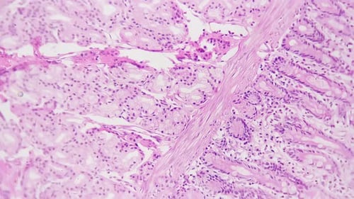 Abschnitt der Pylorusregion unter dem Labormikroskop 200-fach vor hellem Feldhintergrund vergrößert