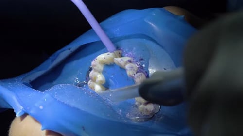 Dental Work on Teeth With Dental Dam