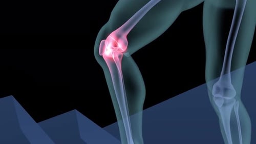 Knee Joint Pain During Stair Climbing Medical Animation