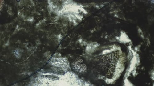 Colonies of Bacteria or Cells Under a Microscope Medical Scientific Laboratory Human Immune System