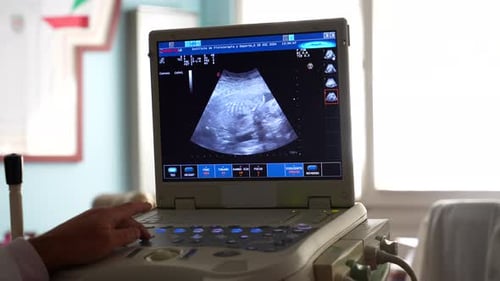 Close up of ultrasound showing baby's heartbeat while gynecologist checks blood levels, 4K