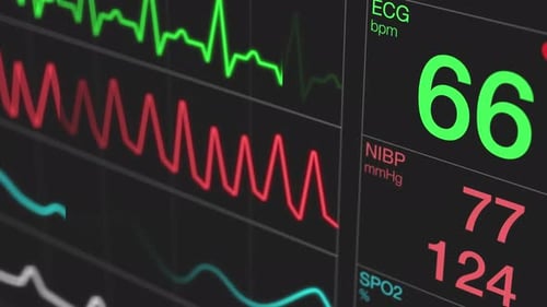 ecg ekg screen