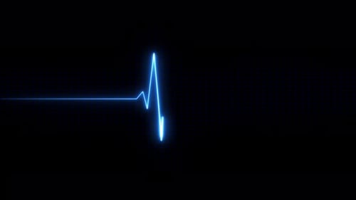 Heartbeat line animation .showing heart pulse on screen.