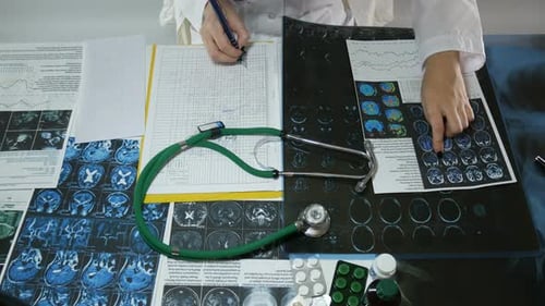 Doctor Analyzes Brain Scans in Clinical Setting