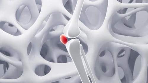 Animated Human Knee Joint with Inflammation