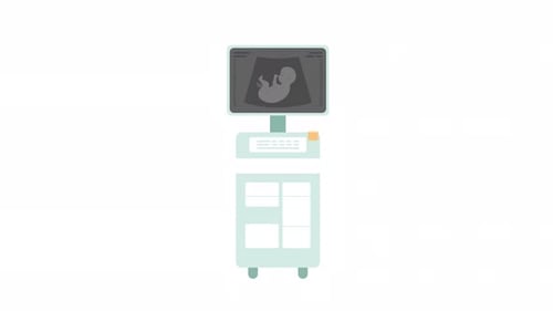 Ultrasound sonogram machine 2D object animation