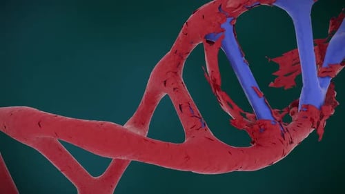 Damaged blood vessel with visible blockage