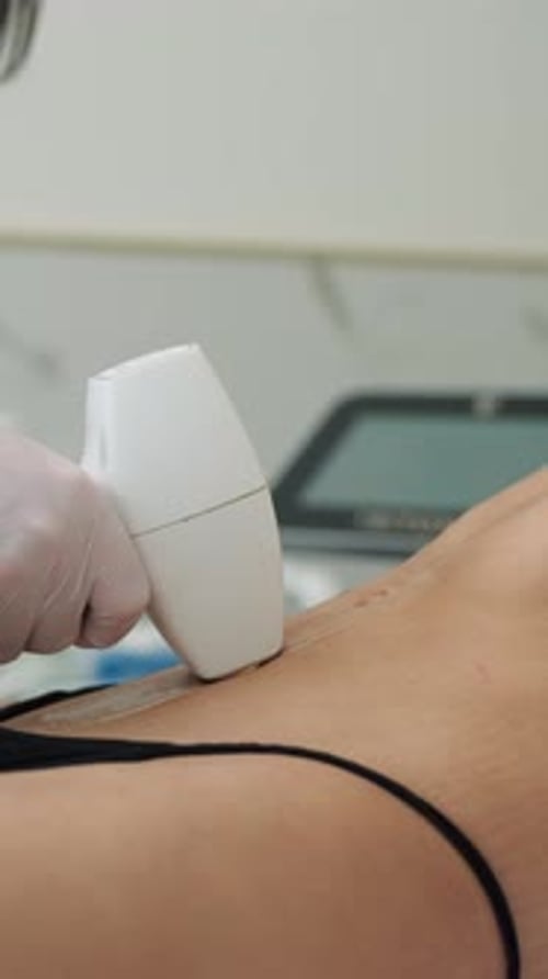 Laser Hair Removal Treatment Close Up