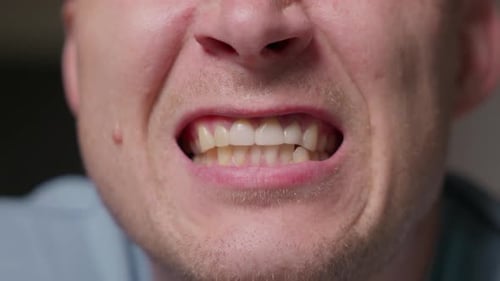 Close Up of Man Grinding Teeth Mouth Detail