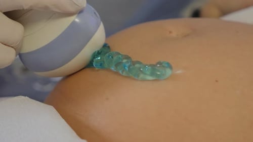 Ultrasound pregnant transducer blue gel pregnancy tummy ultrasonic scanner close-up conductive gel 5