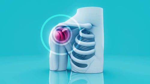 Animated Human Shoulder Joint Pain With Radiating Highlight
