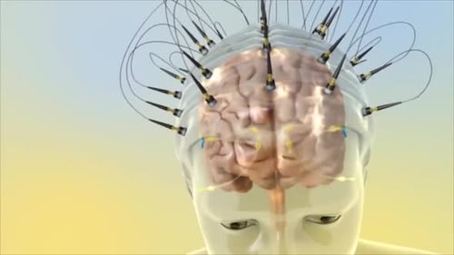 Gehirn mit Elektroden, die die neuronale Aktivität in der modernen Neurowissenschaft stimulieren