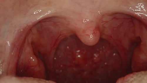 Extreme Close Up of Human Mouth and Throat