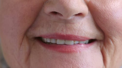 A senior woman with dental issues and yellow teeth due to unhealthy habits