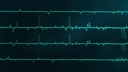 Heartbeat ECG Monitor Animation – Medical Electrocardiogram Vital Sign Background Loop - HD