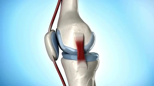 Close up of knee joint and arthritis