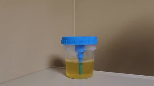 Urine sample filling vacuum test tube for urinalyses.