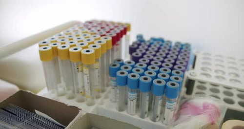 Close Up of Test Tubes in Hospital Setting