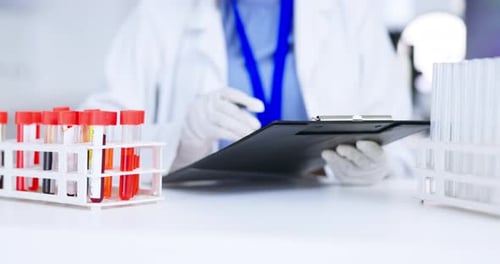 Hands, blood and doctor writing for research, analysis or report in medical study in hospital