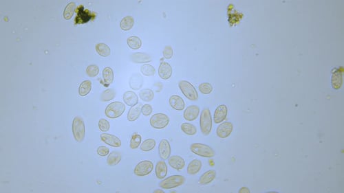 Organismos unicelulares de Paramecium en el campo brillante del microscopio