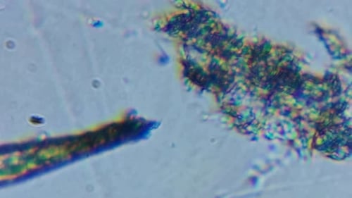 Close up infectious contaminated microbe cell bacteria under microscope