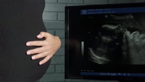 Femme enceinte contre une échographie prénatale
