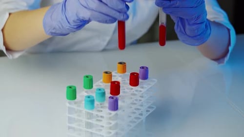 Gloved Hands Placing Blood Sample into Rack