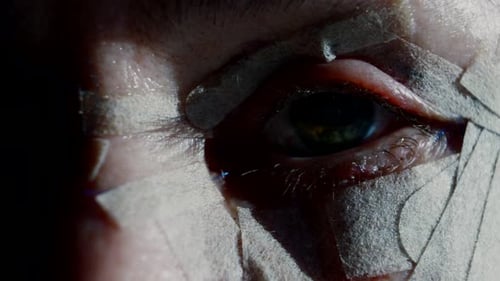 Extreme Closeup of Eyelid Woman Patient's Face After Eyelid Blepharoplasty