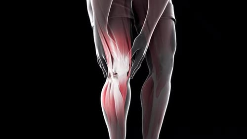 3D Human Knee Pain Anatomy Animation