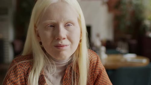 Gen Z Girl With Albinism Portrait