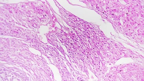 Woman Ovary in Section Magnified Under Microscope in 400 Times Against Bright Field Background