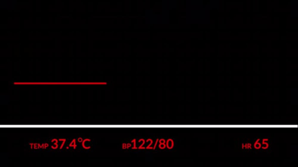 Red Heart Rate EKG Monitor Animation for Medical Content, Backgrounds ...