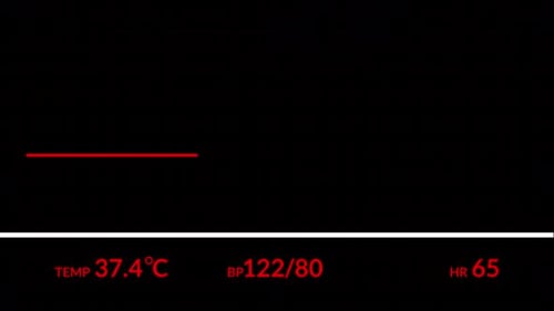 Monitor clínico de ECG Hud
