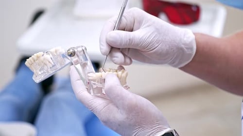 Dentist Holding Teeth Jaw Model in Clinic