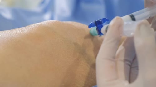 Enlarged Image of an Injection in a Patient's Arm and Knee