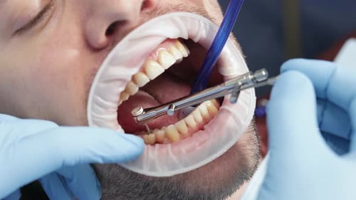 Man at Dentist Having Dental Work