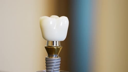 Close-up of a dental implant model on display