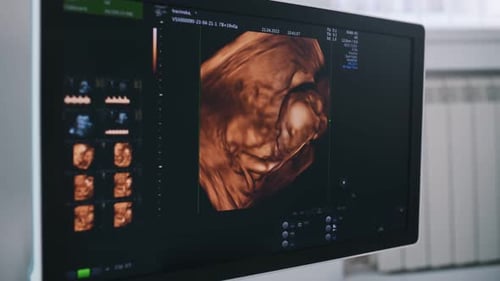 Ultraschallgerät für schwangere Säuglinge. Konzeption des Gesundheitswesens