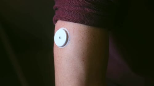 Arm with Medical Monitoring Device Close-Up