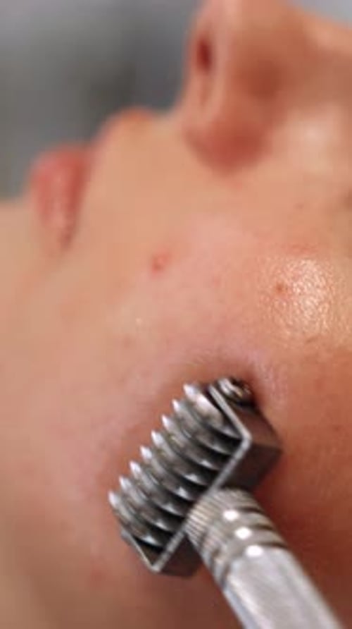 Gesichtsmassage einer Frau mit einem Roller, um das Serum aufzunehmen